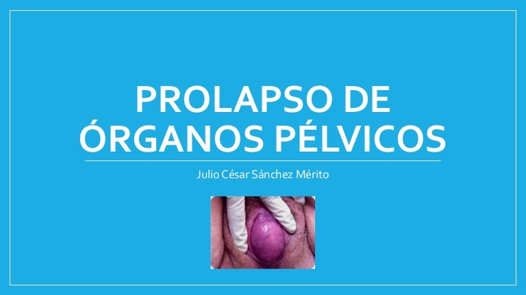 Prolapso de organos pelvicos slideshare Prolapso de organos pelvicos slideshare